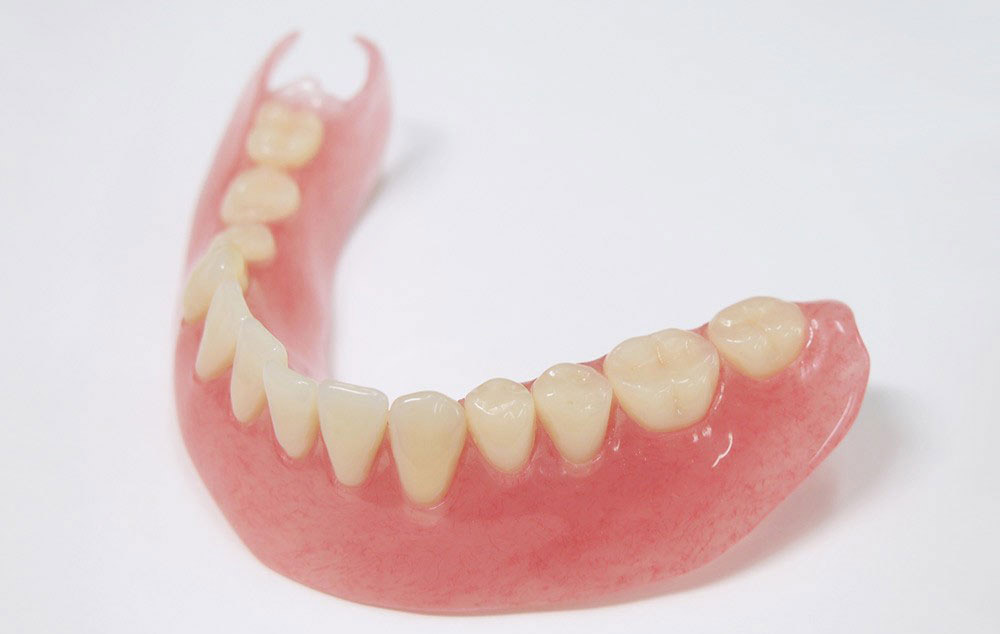 部分入れ歯