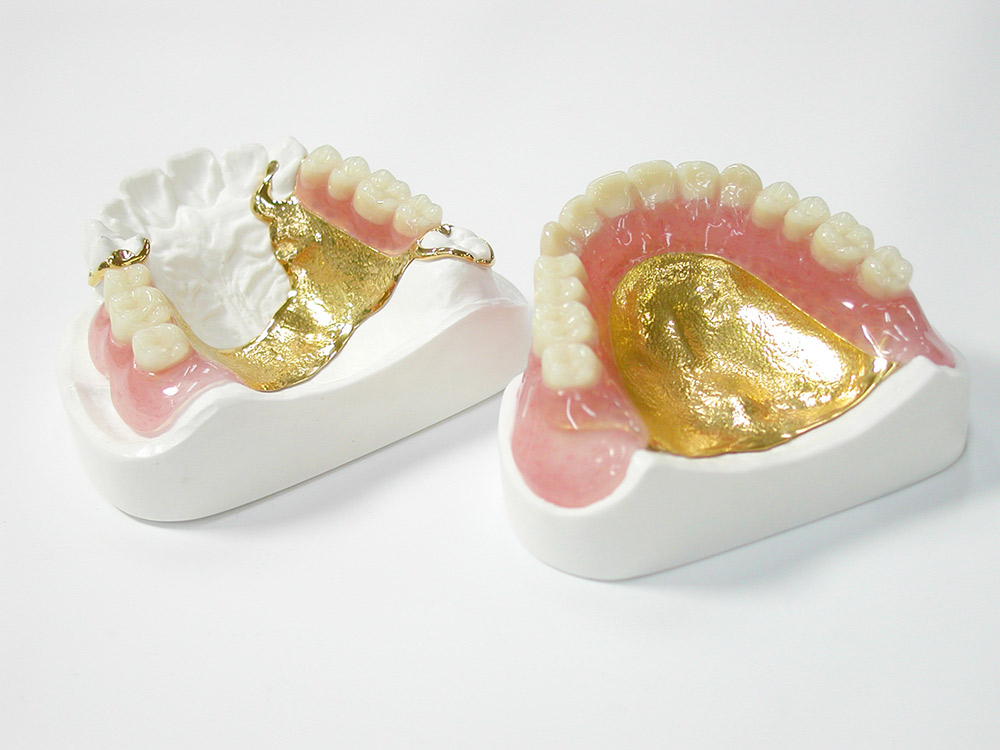 ゴールド義歯