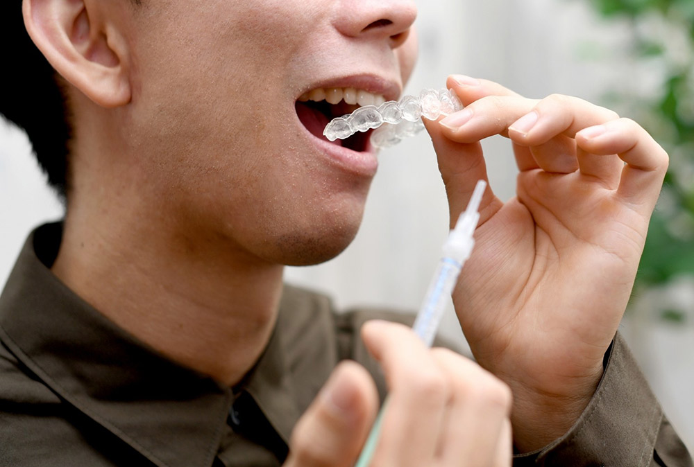 ホワイトニングとは