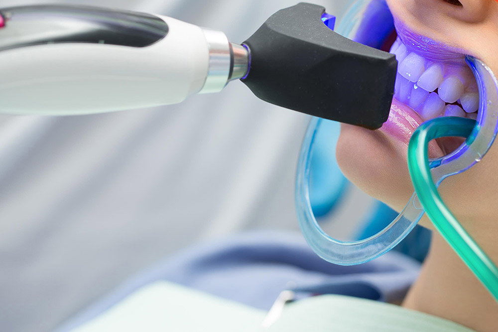 ホームホワイトニング